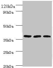 FTSJ1 Antibody
