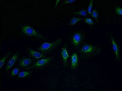 PVRIG Antibody
