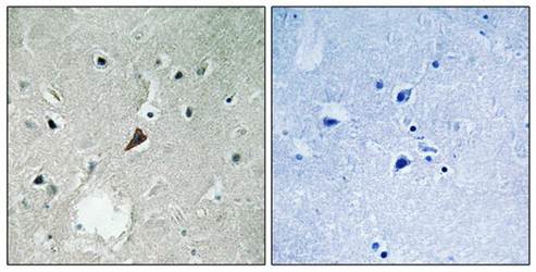 PYK2 (Phospho-Tyr579) Antibody