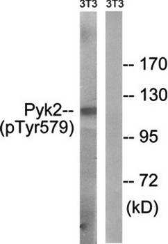 PYK2 (Phospho-Tyr579) Antibody