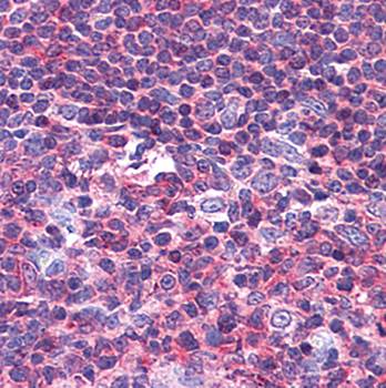PYK2 Antibody