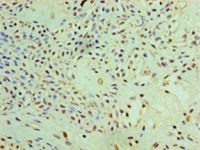PYCR1 Antibody
