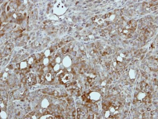Pyruvate Kinase Rabbit Polyclonal Antibody