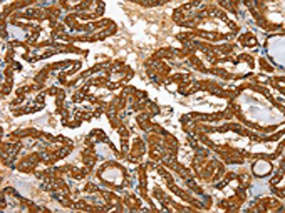 RAB25 Antibody