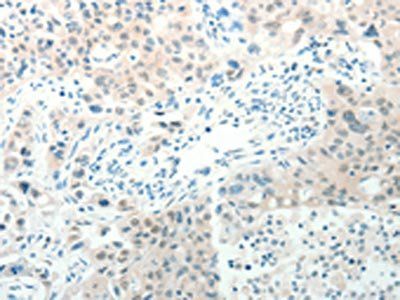 RAB25 Antibody