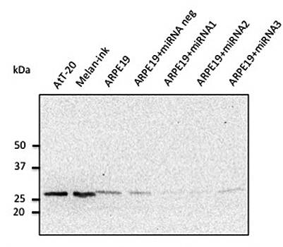 RAB27A, member RAS oncogene family Antibody