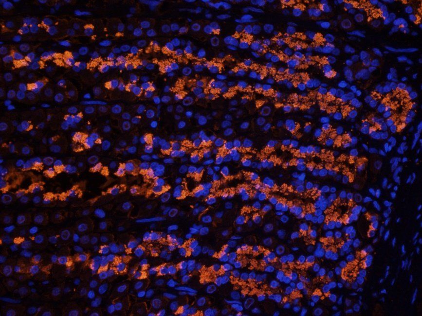 Rab28 Rabbit Polyclonal Antibody