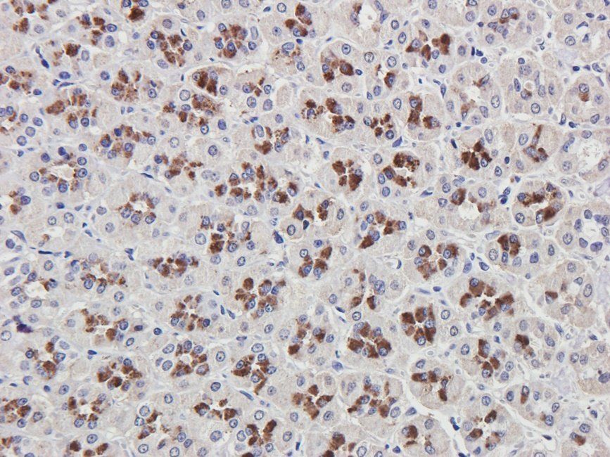Rab28 Rabbit Polyclonal Antibody