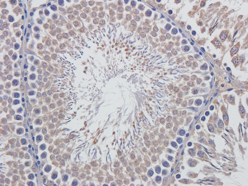 Rab28 Rabbit Polyclonal Antibody