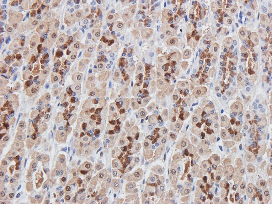 Rab28 Rabbit Polyclonal Antibody