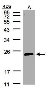 RAB2A, member RAS oncogene family Antibody