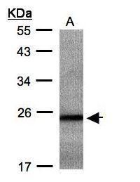 RAB2B, member RAS oncogene family Antibody