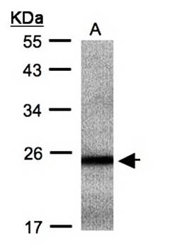 RAB2B antibody