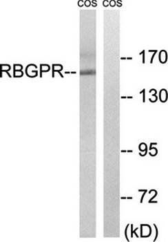 RAB3GAP2 Antibody