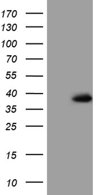 RAB3IP Antibody