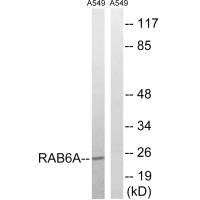RAB6A Antibody