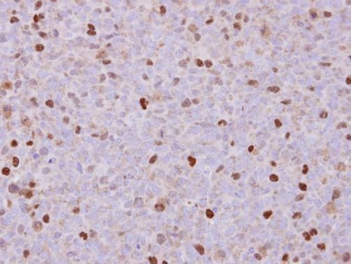 Rac GTPase activating protein 1 Antibody
