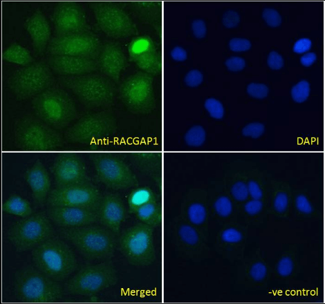 RACGAP1/MgcRacGAP Antibody