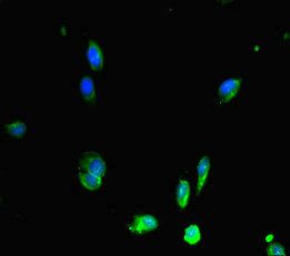 RAD51 Antibody