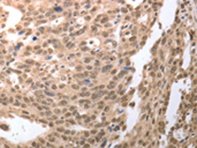 RAD52 Antibody