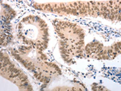 RAD52 Antibody
