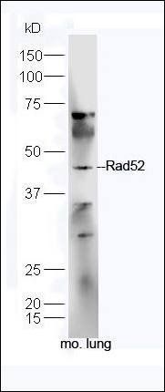 Rad52 Rabbit Polyclonal Antibody