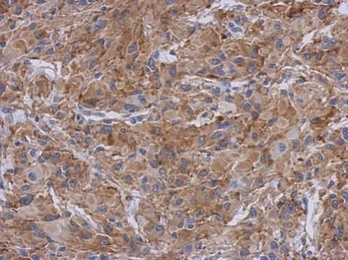 radixin Antibody