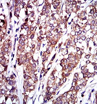 RAF1 Antibody