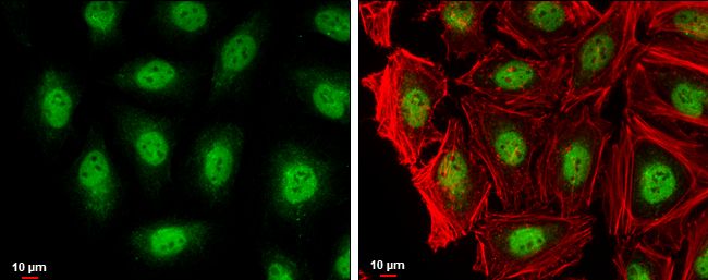 RAG2 Rabbit Polyclonal Antibody