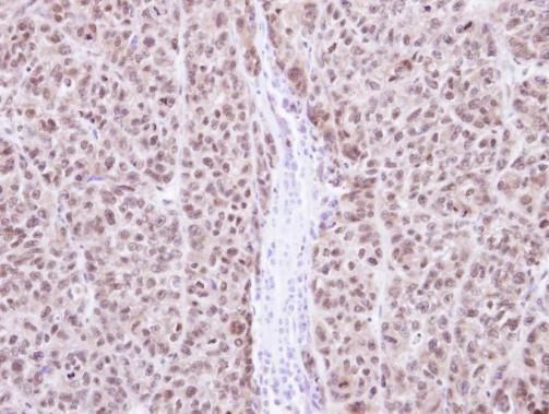 RAG2 Rabbit Polyclonal Antibody