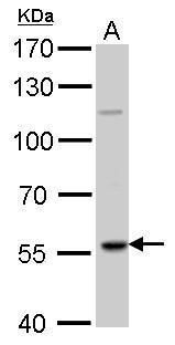 RAG2 Rabbit Polyclonal Antibody