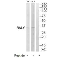 RALY Antibody