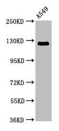 RANBP17 Antibody