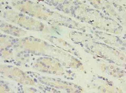 RANBP2 Antibody