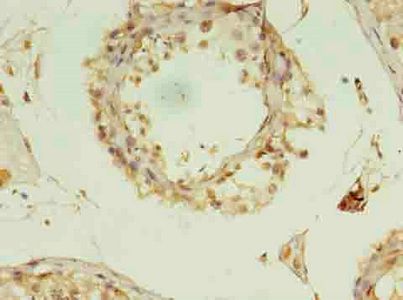 RANBP2 Antibody