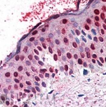 RanGAP1 Antibody