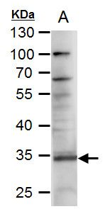 RANKL antibody [C2C3], C-term