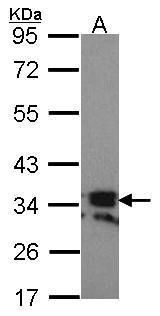 RANKL antibody [C2C3], C-term