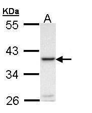 RANKL antibody [C2C3], C-term