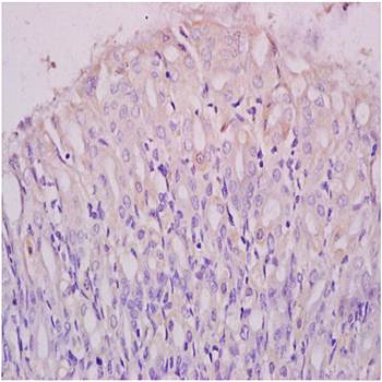 RAP2B Rabbit Polyclonal Antibody