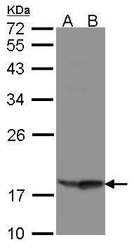 RARRES3 antibody [N3C3]