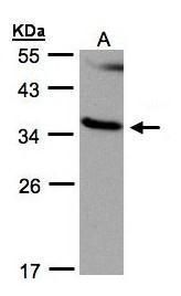 Ras association domain family member 1 Antibody