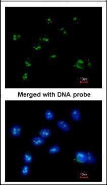 RASSF2 Rabbit Polyclonal Antibody