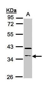 RASSF2 Rabbit Polyclonal Antibody