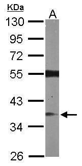 RASSF2 Rabbit Polyclonal Antibody