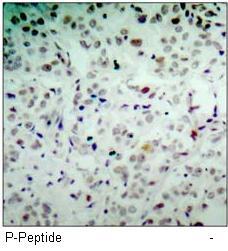 Rb (Phospho-Ser780) Antibody