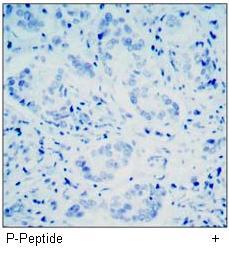 Rb (Phospho-Ser780) Antibody