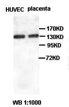 RBBP6 Rabbit Polyclonal Antibody