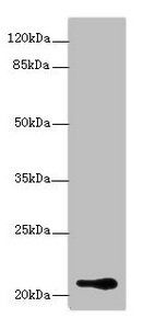 RBBP9 Antibody