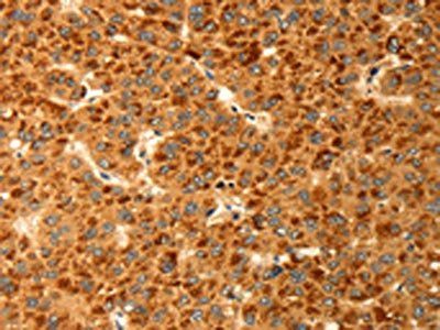 RBBP9 Antibody